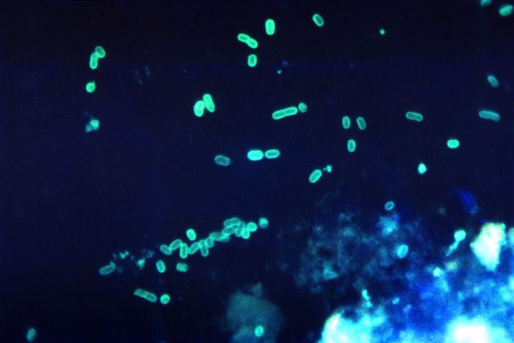 fluorescent-antibody-stained-photomicrograph-depicted-numbers-of-gram-negative-enteropathogenic-escherichia-coli-725x483
